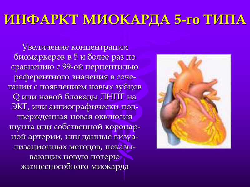 ИНФАРКТ МИОКАРДА 5-го ТИПА Увеличение концентрации биомаркеров в 5 и более раз по сравнению